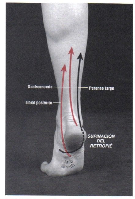 Tobillera para esguince de tobillo – Tobillera ajustable para esguinces,  distensiones, inflamación, hinchazón, dolor, tobilleras para mujeres y